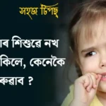 আপোনাৰ শিশুৱে নখ কামুৰি থাকে ? কেনেকৈ এৰুৱাব ? সহজ টিপছ্।